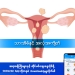 Uterus and cysts