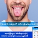 What the color of your tongue says about your health